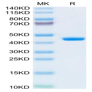 Human B2M/beta 2-Microglobulin Protein (B2M-HM201)