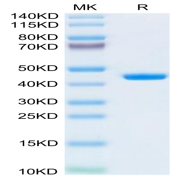 Human B2M/beta 2-Microglobulin Protein (B2M-HM201)