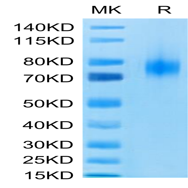 Human B7-1/CD80 Protein (B71-HM280)