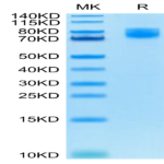 Human B7-2/CD86 Protein (B72-HM286)