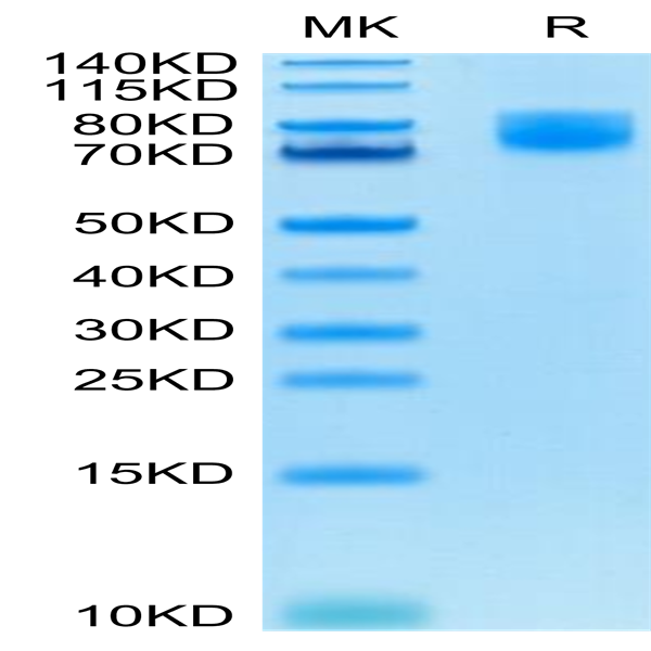Human B7-2/CD86 Protein (B72-HM286)