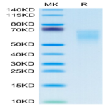 Human B7-2/CD86 Protein (B72-HM486)