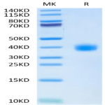 SARS-CoV-2 Spike RBD (Omicron BA.2.38) Protein (BA2-HM138)