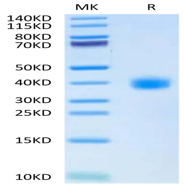 SARS-CoV-2 Spike RBD (Omicron BA.2.38) Protein (BA2-HM138)
