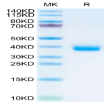 SARS-CoV-2 Spike RBD (Omicron BA.2.75.2) Protein (BA2-HM152)