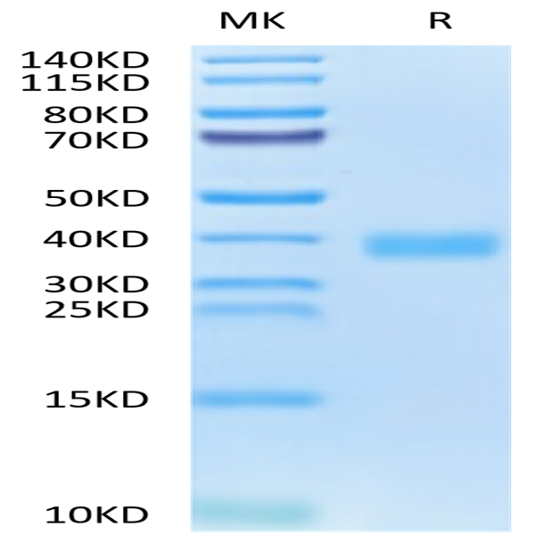 SARS-CoV-2 Spike RBD (Omicron BA.2.74) Protein (BA2-HM174)