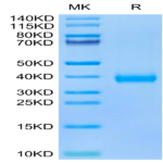 SARS-CoV-2 Spike RBD (Omicron BA.2.75) Protein (BA2-HM175)