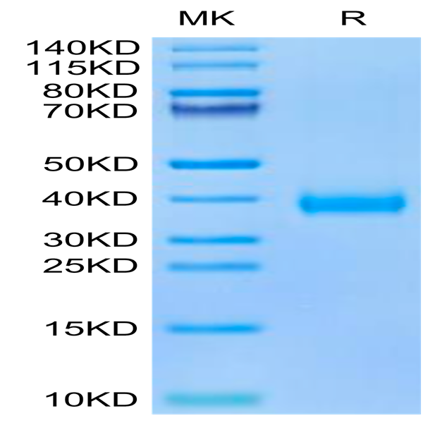 SARS-CoV-2 Spike RBD (Omicron BA.2.75) Protein (BA2-HM175)