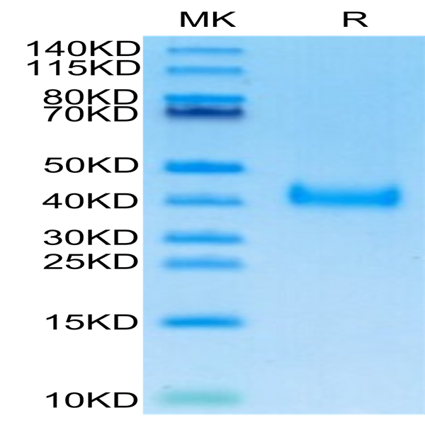 SARS-Cov-2 Spike RBD (Omicron BA.2.12.1) Protein (BA2-VM121)