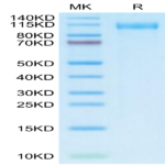 SARS-CoV-2 Spike S1 (Omicron BA.2.12.1) Protein (BA2-VM1S1)
