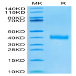 SARS-CoV-2 Spike RBD (Omicron BA.4/BA.5/BA.5.1.3/BA.5.2) Protein (BA4-VM145)