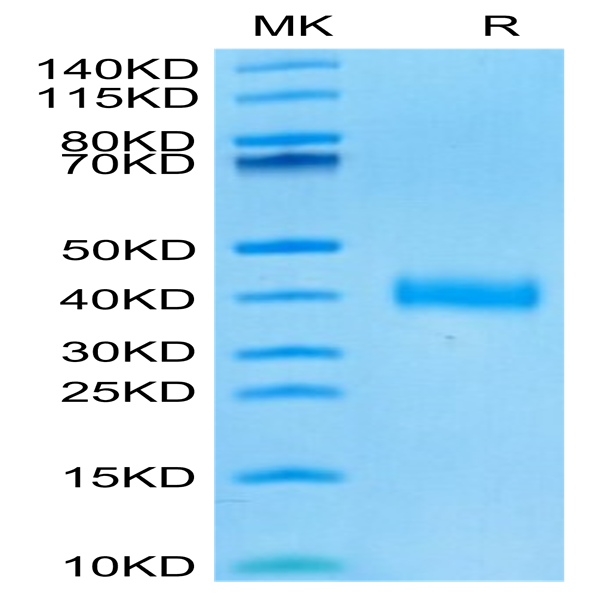 SARS-CoV-2 Spike RBD (Omicron BA.4/BA.5/BA.5.1.3/BA.5.2) Protein (BA4-VM145)
