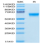 Human BACE-1 Protein (BAE-HM101)