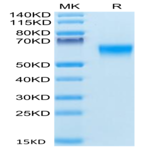 Human BACE-1 Protein (BAE-HM101)