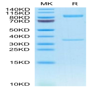 Human BACE-1 Protein (BAE-HM201)