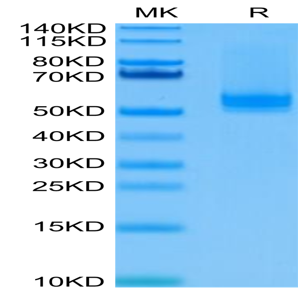 Human BAFF/TNFSF13B/CD257 Trimer Protein (BAF-HM112)