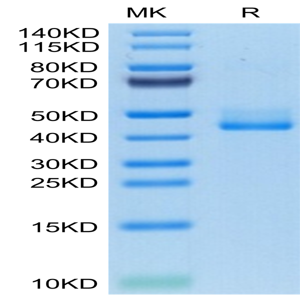 Human BAFFR/TNFRSF13C Protein (BAF-HM201)