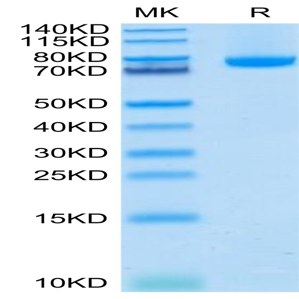 Human BAFF/TNFSF13B/CD257 Trimer Protein (BAF-HM213)