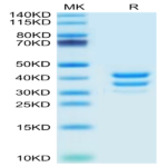 Mouse BAFFR/TNFRSF13C Protein (BAF-MM20R)