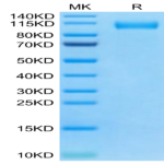 SARS-CoV-2 Spike S1 (Omicron BA.4/BA.5/BA.5.2) Protein (BAS-VM145)