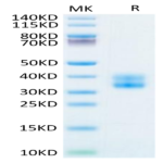 Biotinylated Human 4-1BB/TNFRSF9 Protein (BB4-HM441B)