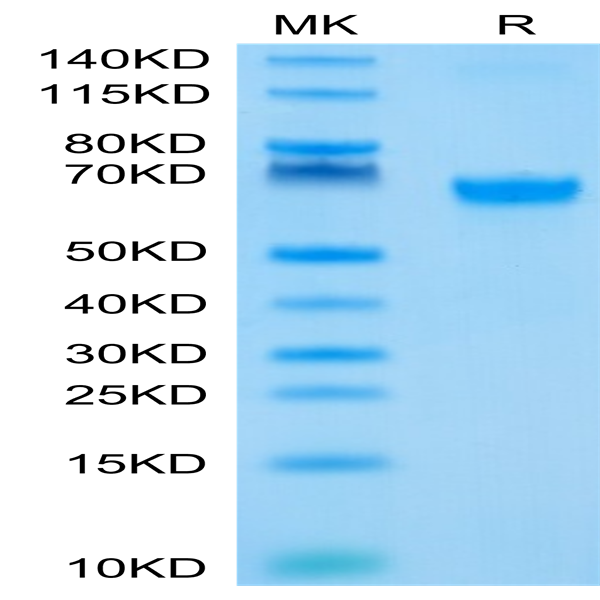 Biotinylated Human 4-1BB/TNFRSF9 Protein (BB4-HM541B)