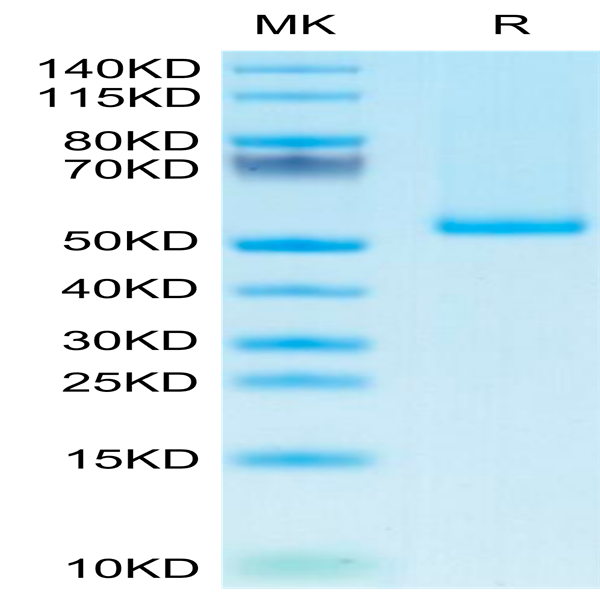Human 4-1BB Ligand/TNFSF9 Trimer Protein (BBL-HM141)