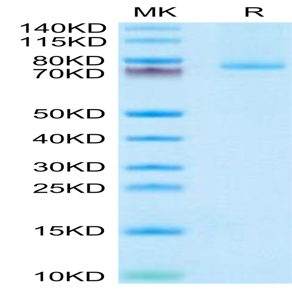 Human 4-1BB Ligand/TNFSF9 Trimer Protein (BBL-HM241)
