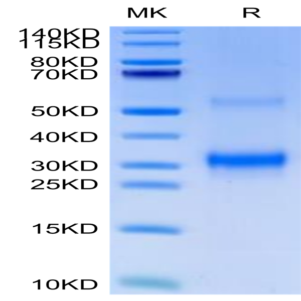 Cynomolgus BDCA-2 Protein (BCA-CM102)