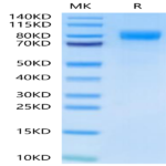 Human BCHE/Butyrylcholinesterase Protein (BCE-HM101)