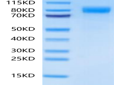 Human BCHE/Butyrylcholinesterase Protein (BCE-HM101)