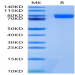 Mouse BCHE/Butyrylcholinesterase Protein (BCE-MM101)