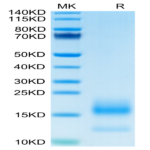 Human BCMA/TNFRSF17 Protein (BCM-HM117)