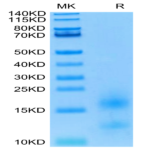 Biotinylated Human BCMA/TNFRSF17 Protein (BCM-HM117B)