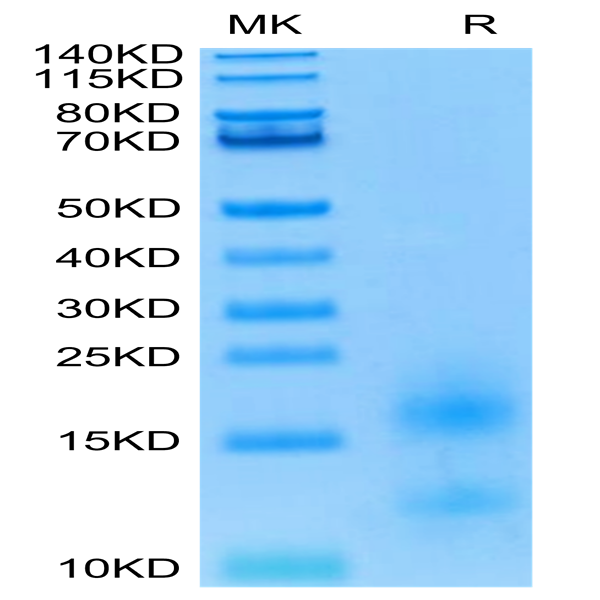 Biotinylated Human BCMA/TNFRSF17 Protein (BCM-HM117B)