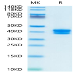 FITC-Compatible Human BCMA/TNFRSF17 Protein (BCM-HM117C)