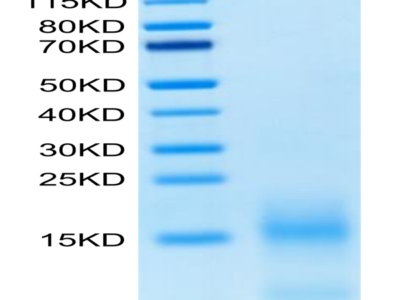 FITC-Labeled Human BCMA/TNFRSF17 Protein (BCM-HM117F)