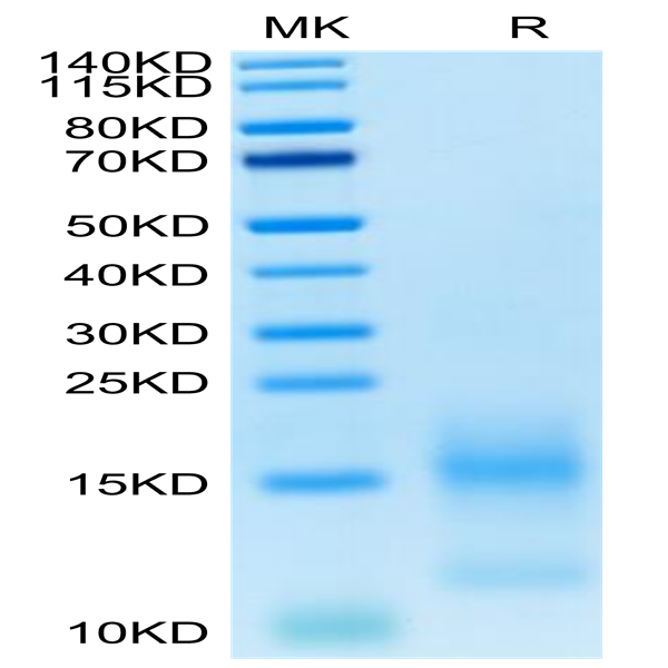 FITC-Labeled Human BCMA/TNFRSF17 Protein (BCM-HM117F) FITC-Labeled Human BCMA/TNFRSF17 Protein (BCM-HM117F)