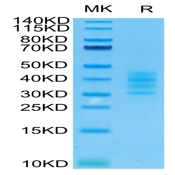 Human BCMA/TNFRSF17 Trimer Protein (BCM-HM417)