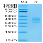 Biotinylated Human BCMA/TNFRSF17 Trimer Protein (BCM-HM417B)