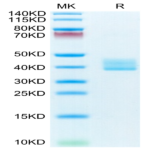 Mouse BCMA/TNFRSF17 Protein (BCM-MM217)