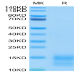 Mouse BCMA/TNFRSF17 Protein (BCM-MM417)