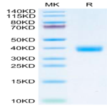 SARS-CoV-2 Spike RBD (Omicron BF.7/BA.4.6) Protein (BF7-HM146)