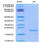 Human BPIFA1/LUNX Protein (BFA-HE0A1)