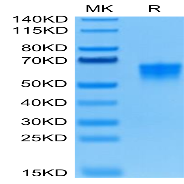 Human B7-H4 Protein (BH7-HM174)