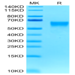 Biotinylated Human B7-H4 Protein (BH7-HM174B)