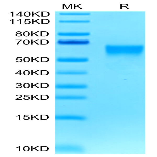 Biotinylated Human B7-H4 Protein (BH7-HM174B)