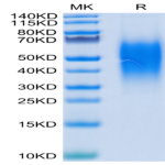 Human B7-H5/Gi24/VISTA Protein (BH7-HM175)