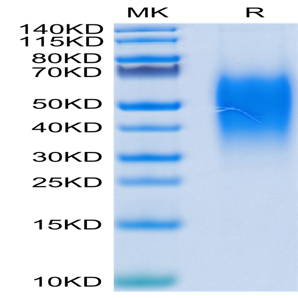 Human B7-H5/Gi24/VISTA Protein (BH7-HM175)