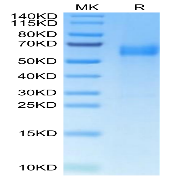 Human B7-H7/HHLA2 Protein (BH7-HM177)